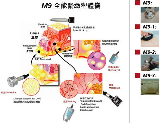 M9